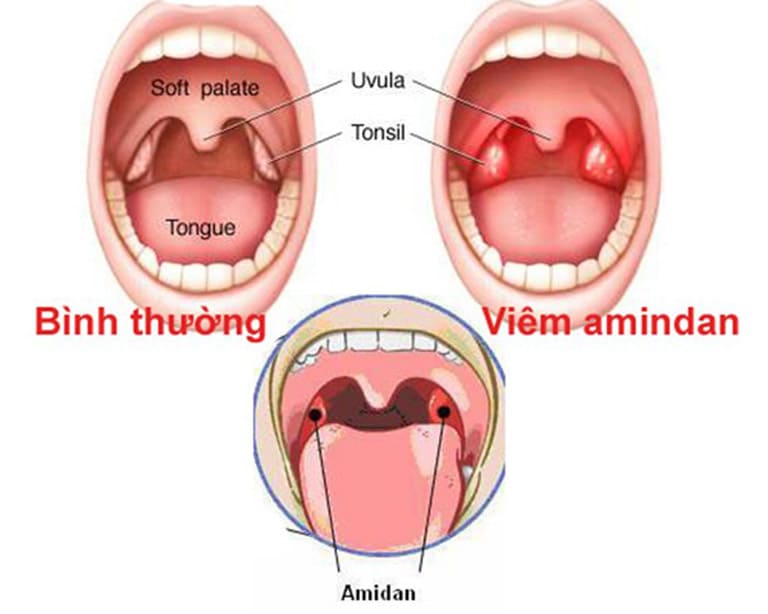 Amidan bình thường như thế nào?