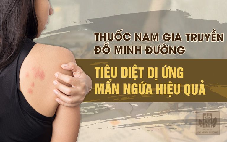 bài thuốc chữa dị ứng thời tiết hiệu quả và an toàn của Đỗ Minh Đường