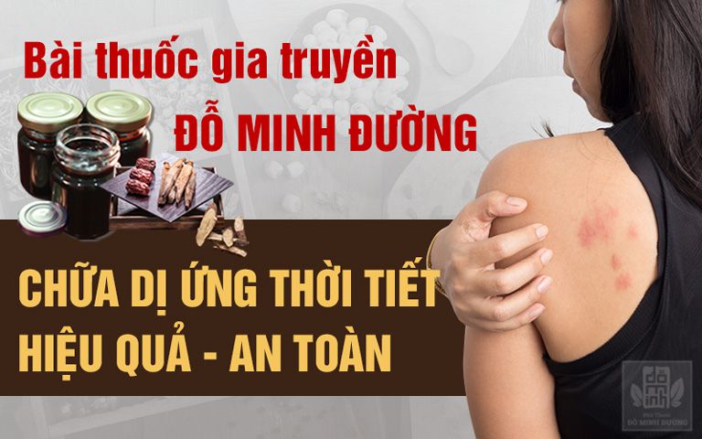 Bài thuốc chữa dị ứng thời tiết của Đỗ Minh Đường an toàn, hiệu quả cao