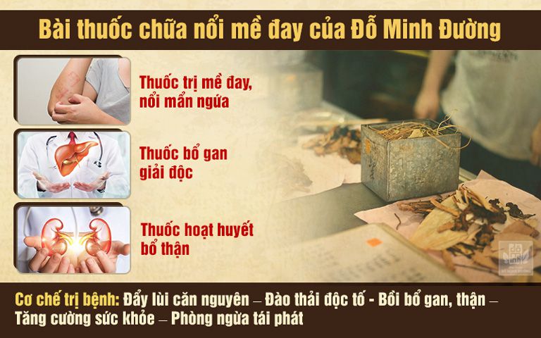 Bài thuốc mề đay Đỗ Minh