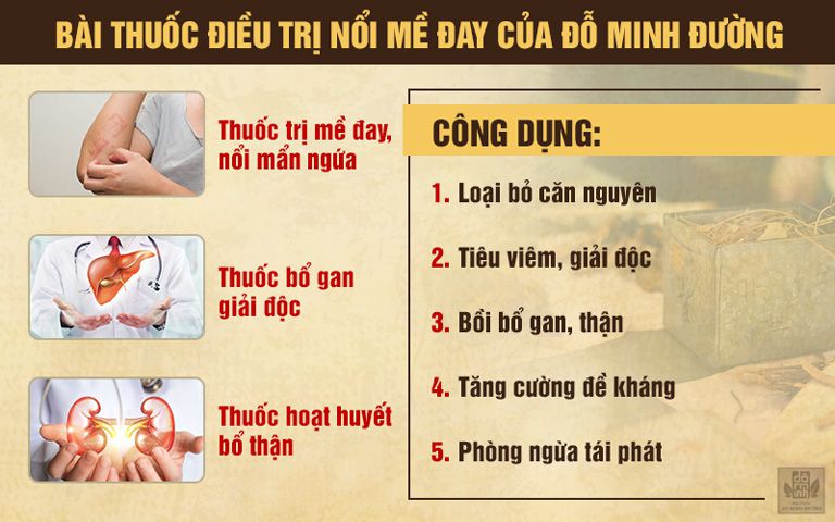 bài thuốc chữa nổi mề đay hiệu quả và an toàn của Đỗ Minh Đường