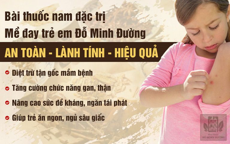 Mề đay Đỗ Minh