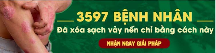 Banner vảy nến 3597