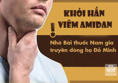 viêm amidan đỗ minh đường