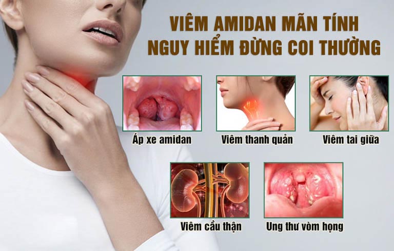 Viêm Amidan mãn tính có thật sự nguy hiểm?