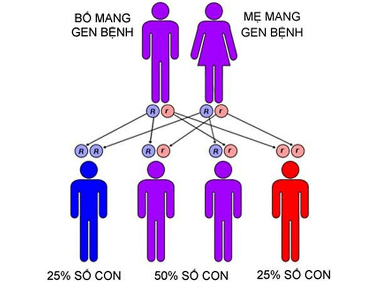 Bệnh gout có lây nhiễm hay di truyền không?