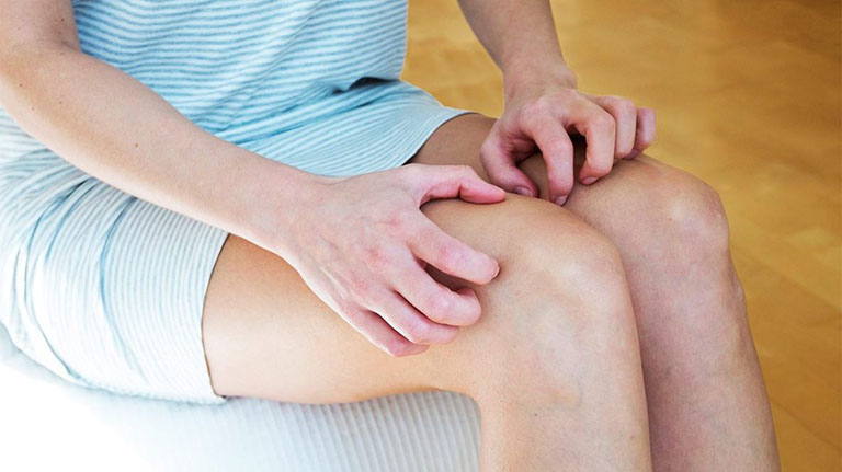 Bị viêm da tiếp xúc bao lâu khỏi Bị viêm da tiếp xúc bao lâu khỏi