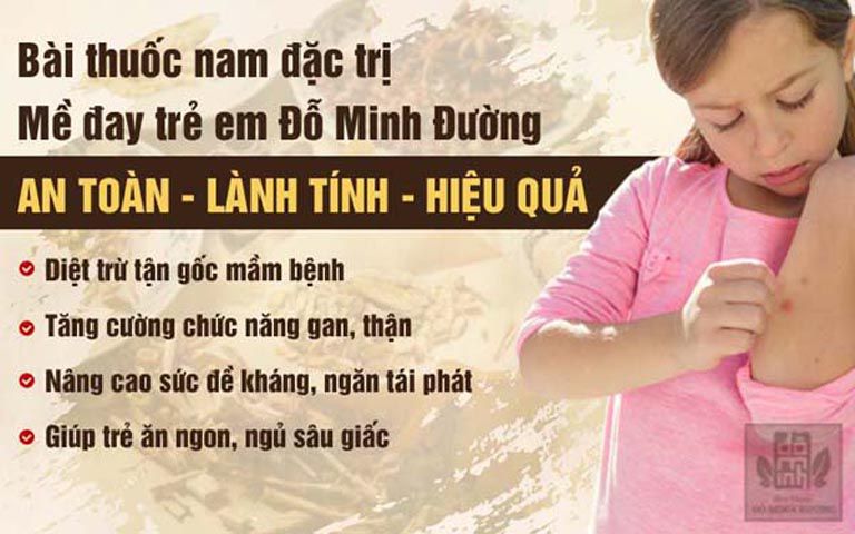 Ưu điểm chữa nổi mề đay cho trẻ em tại Đỗ Minh Đường