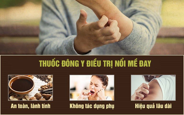 Thuốc Đông y chữa nổi mề đay ở trẻ em an toàn và hiệu quả