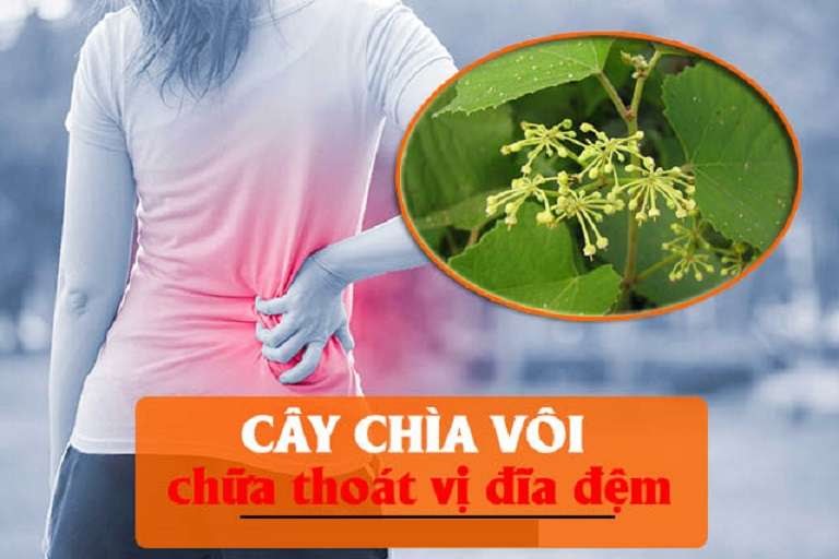 Chìa vôi được sử dụng để điều trị thoát vị đĩa đệm