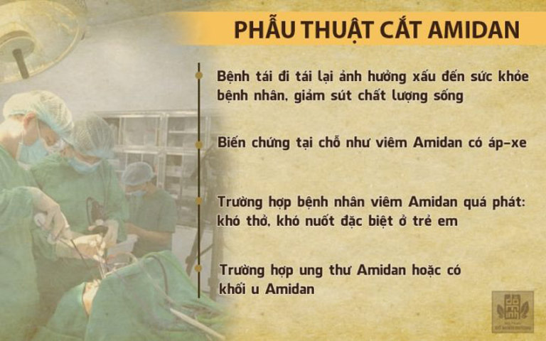 Nguy hiểm khi cắt amidan