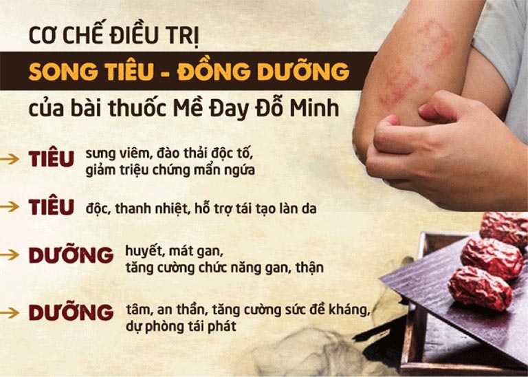 Cơ chế trị mề đay của phòng khám đỗ minh đường