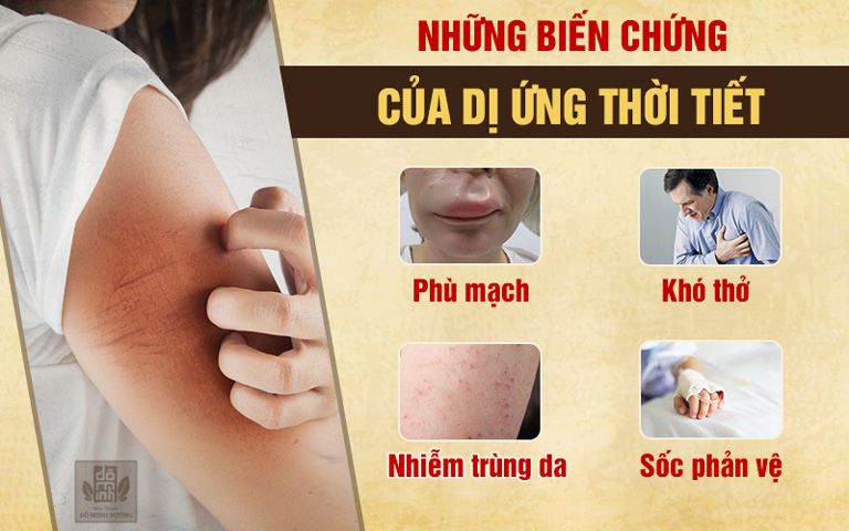 Các biến chứng nguy hiểm của dị ứng thời tiết