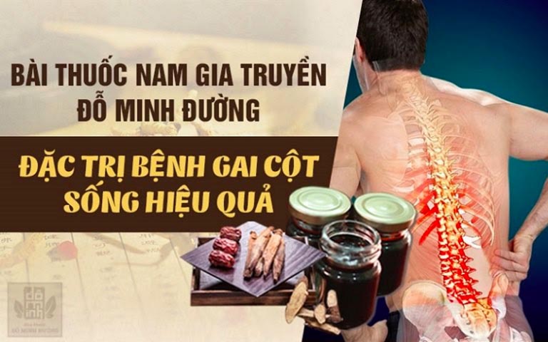 Đặc trị gai cột sống đông y đỗ minh đường