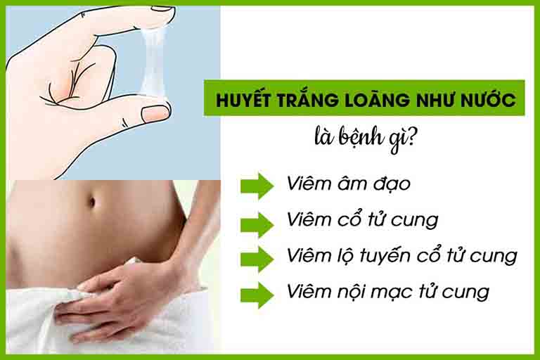 Khí hư ra nhiều loãng như nước