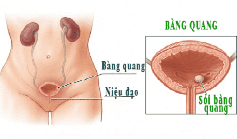 Bài thuốc từ Mã Đề giúp tán sỏi bàng quang