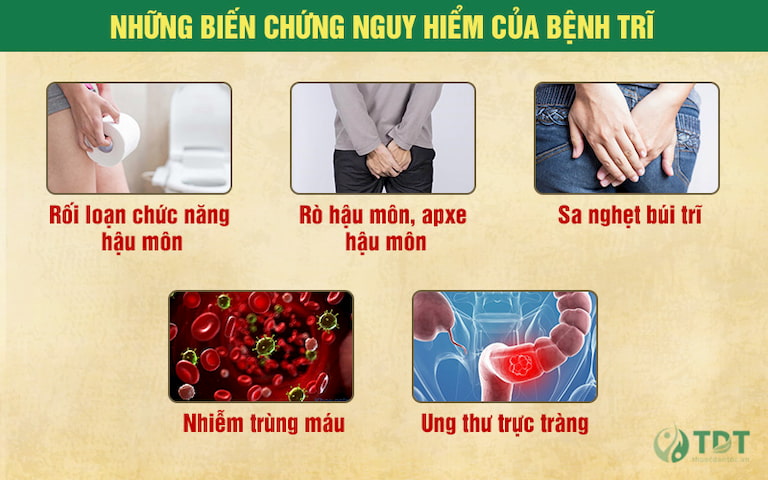 Những biến chứng của bệnh trĩ