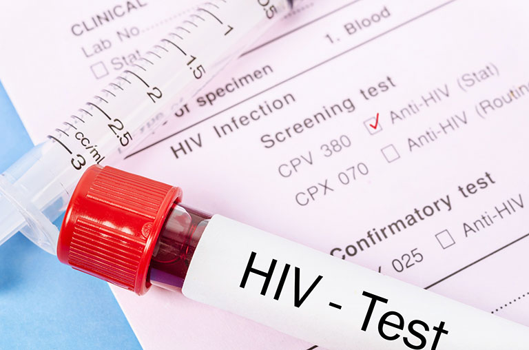 nổi mề đay do hiv