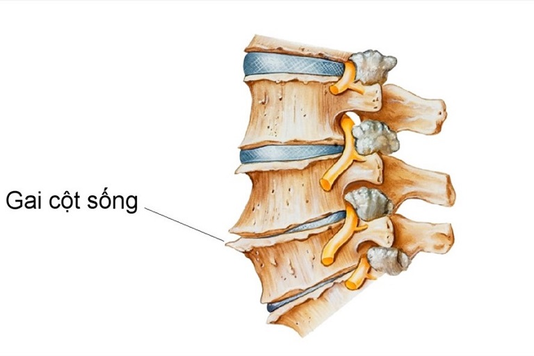 rau dền gai chữa bệnh gai cột sống