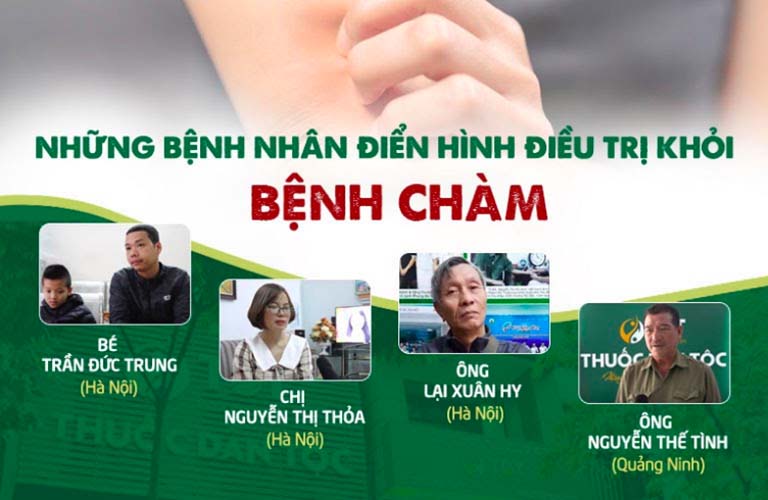 Thanh bì dưỡng can thang chữa bệnh chàm thuốc dân tộc