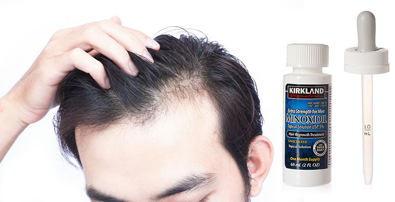 minoxidil 5 kirkland có tốt không