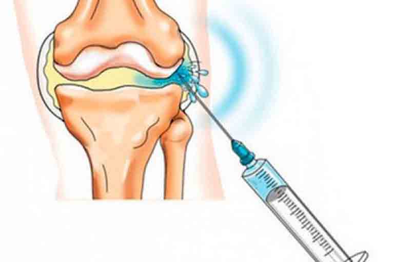 Bị tràn dịch khớp gối có nên hút dịch không?