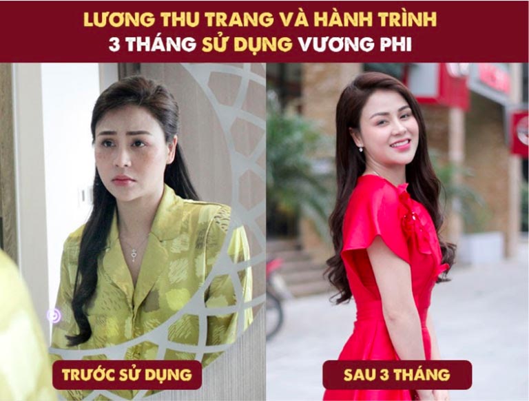 truoc-va-sau-su-dung-tri-nam-da-vuong-phi Trước và sau khi sử dụng trị nám da Vương Phi