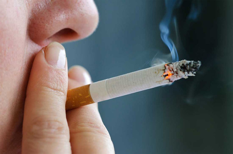 Viêm da tiết bã có tự hết không Viêm da tiết bã có tự hết không