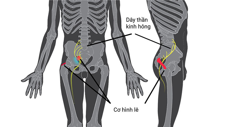 viêm khớp cùng chậu có nguy hiểm không