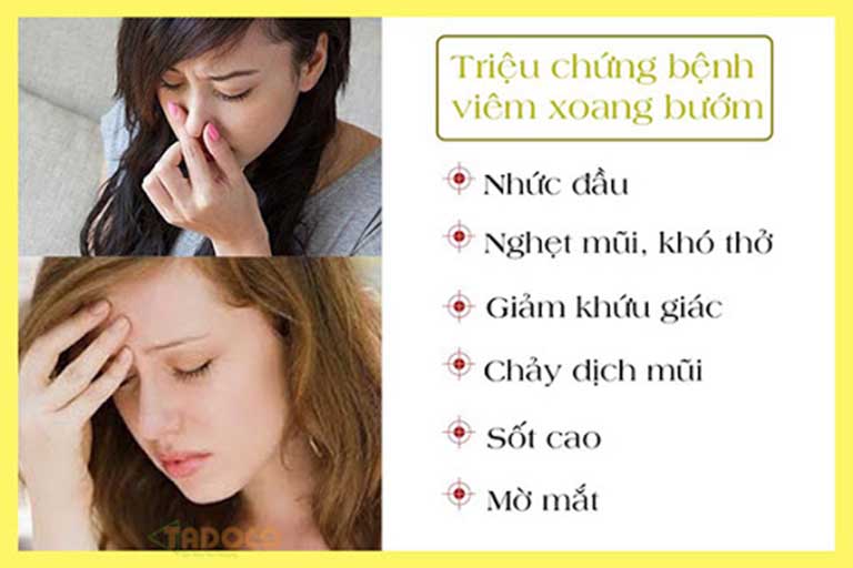 Viêm xoang bướm