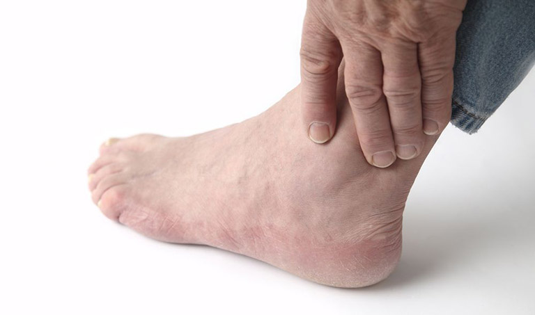 Xét nghiệm chẩn đoán bệnh gout