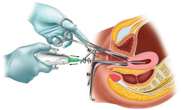 Thai 4 tuần tuổi có hút được không