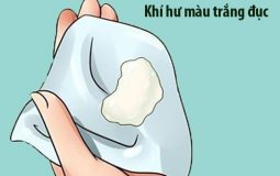 [TOP 20] Cách chữa khí hư màu trắng đục từ dân gian, Đông y, Tây y