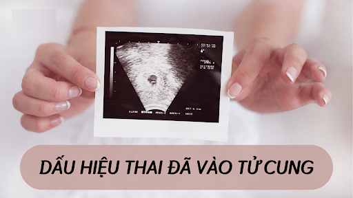 dau hieu thai da vao tu cung