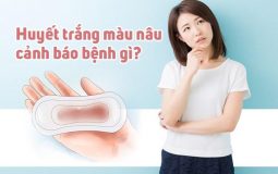 [Khí hư màu nâu nhạt] Nguyên nhân và cách điều trị hiệu quả