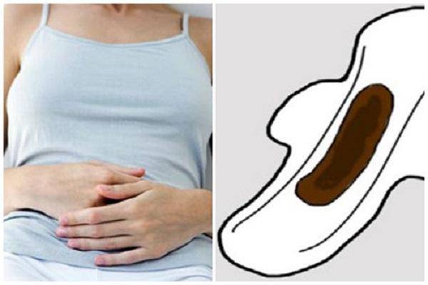 Thế nào là kinh nguyệt nài đen