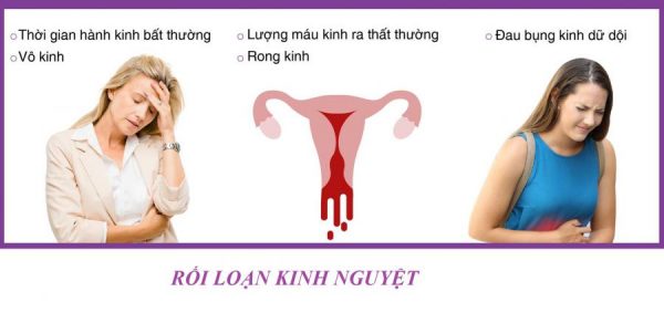 Dấu hiệu nhận biết vòng kinh nguyệt bất thường