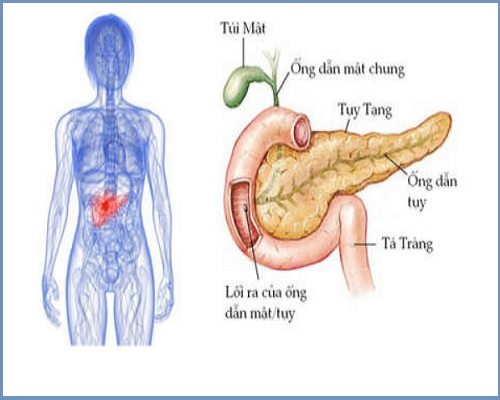 Tại sao bị đau bụng âm ỉ nhiều ngày? Viêm tụy cấp